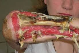 krokodil.jpg